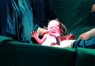 Διάρκεια τοκετού και Στάδιο διαστολής