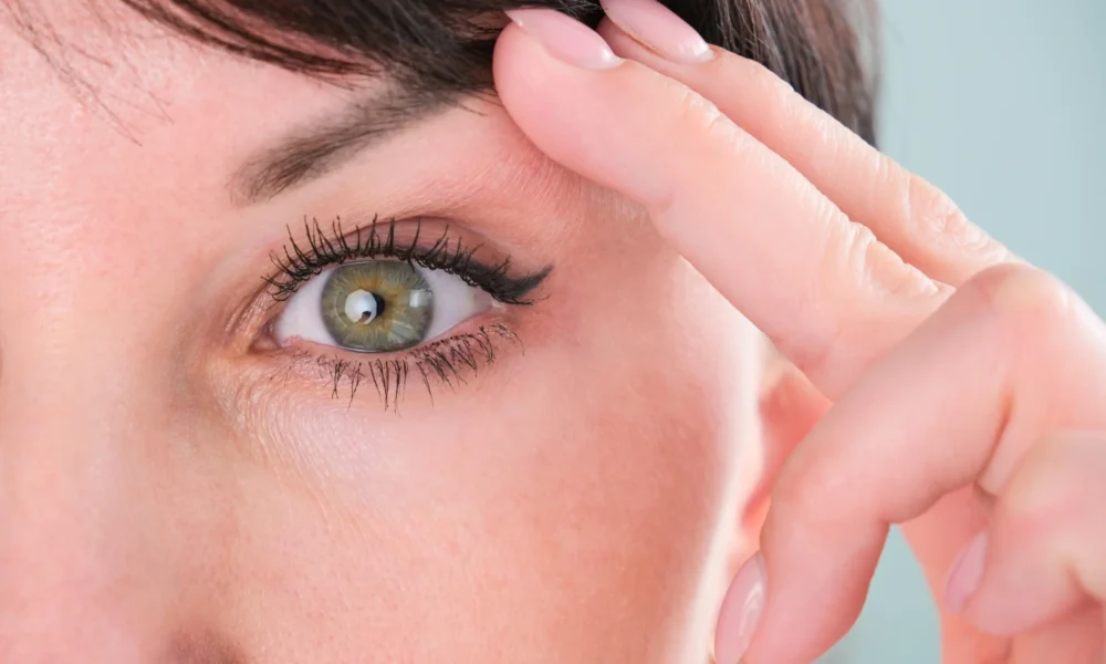 5 έξυπνα βήματα για αποφυγή του Lifting